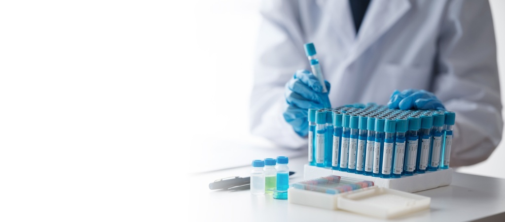 Porphobilinogen 100mg